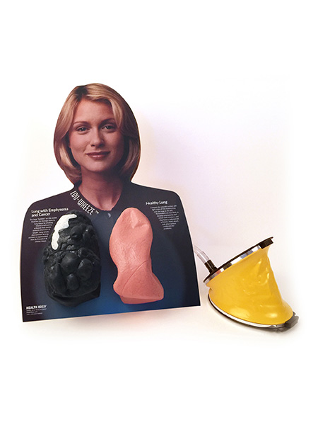 Lou-Wheeze Smoker's Lungs Comparison Model